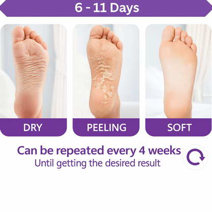 2 Exfoliating Lemon Foot Peel Masks