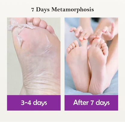 Exfoliating Foot Peel Mask | 1 Pair Lavender Socks | Removes Dead Skin