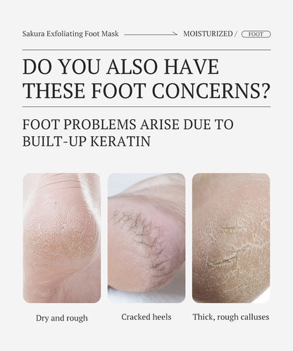 3x Cherry Exfoliating Foot Peel Masks
