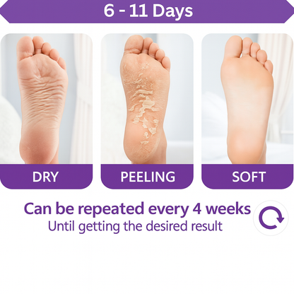 1 Lavender Exfoliating  Foot Peel Socks