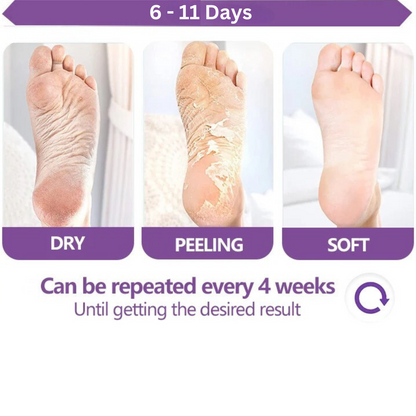 Derma v10 Moisturising Exfoliating Foot Mask
